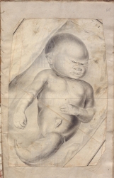 37.     (           ).   I  : Abrahami Kaau Boerhaave Historia anatomica infantis, cuius pars corporis inferior monstrosa. Petropoli, 1754.  . 
.  .  .    , .  . 
268  182
1754 . 
. III. . 1. . 10. . 60.
